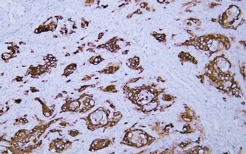 Cytokeratin 13 (ABT-CK13) mouse mAb