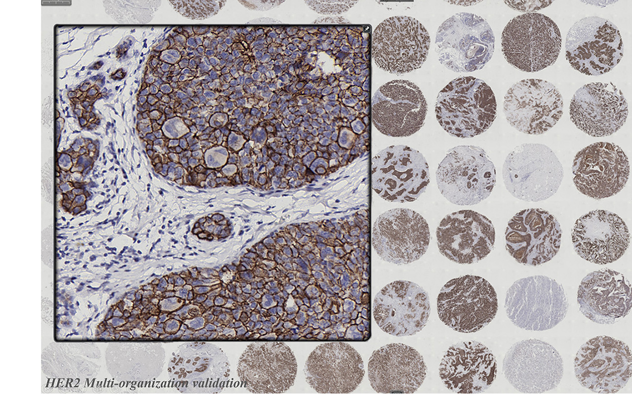 HER2 / Ki-67 / Cytokeratin mouse mAb(Pathological grade antibody)